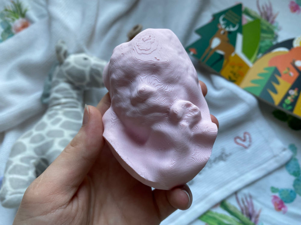 3D printed 3D ultrasound